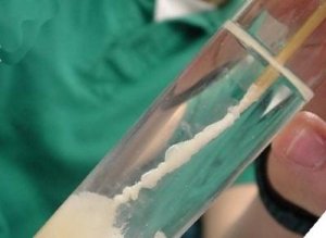 How the extract DNA